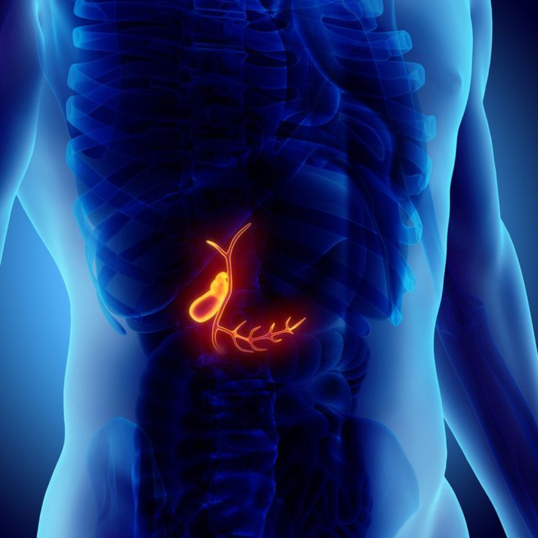 Pancreatic Stones: Early Signs, Causes & Best Treatment Options